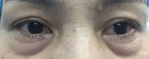 春天把这3种肝毒排干净，整个人都变了，脾气好、睡眠好、气色好！休闲区蓝鸢梦想 - Www.slyday.coM