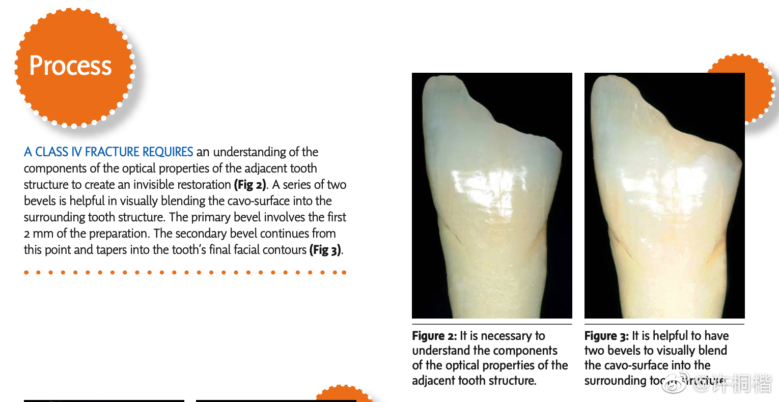 本文作者提倡在四类洞时在边缘放两个角度的双斜面……_高清图集_新浪