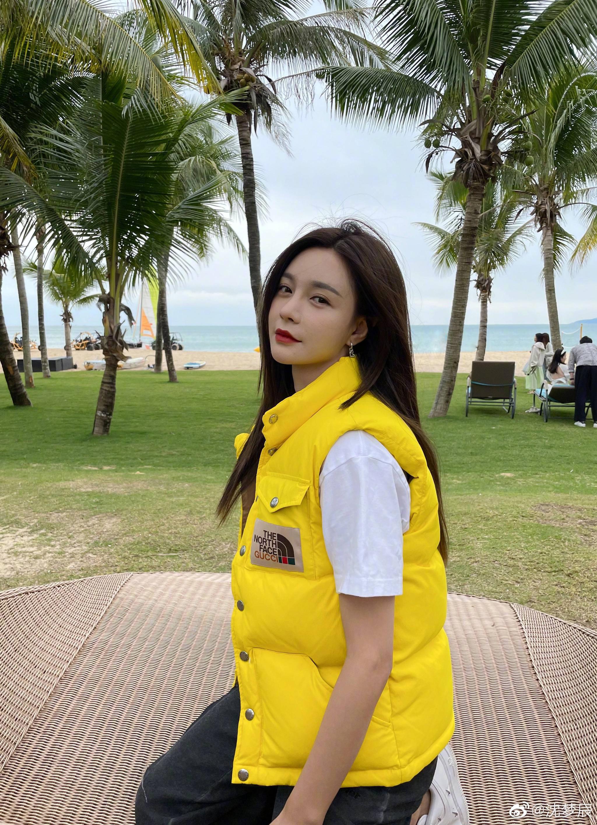 沈梦辰微博发布了一张自己头顶上斑秃的图片