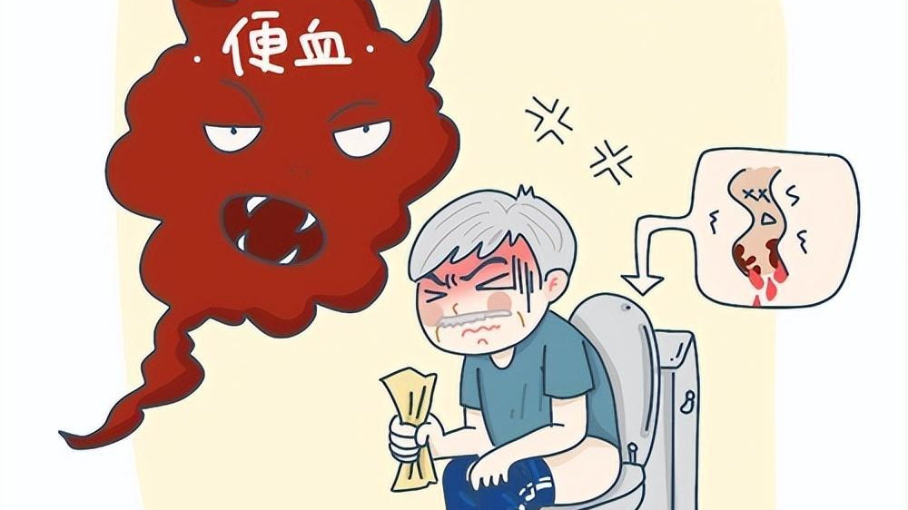 便血不要忽视!医生提醒:5个常见病因,早诊断早治疗|下消化道出血|消化道出血|肛门出血|上消化道出血|胃部疾病_新浪新闻