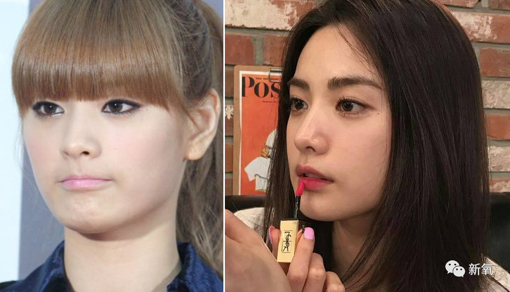 所以,nana急需一个漂亮,有线条感的鼻子加强脸部的惊艳度和气质,同时