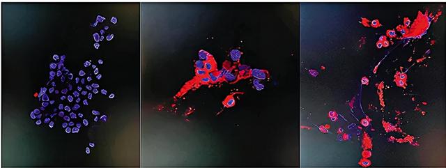 香港累计发现4例感染“奥密克戎”！12月1日深圳新增1例境外输入确诊病例休闲区蓝鸢梦想 - Www.slyday.coM