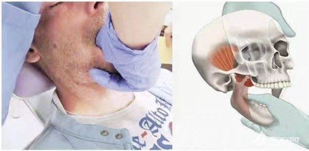 核酸采样时下巴脱臼口腔专家远程连线指导复位做核酸千万别快速大张口