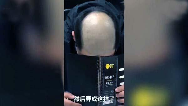 男子被女友恶搞成地中海式发型这还怎么见人啊