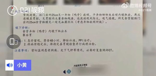 吃鸭头突然被卡喉!上海一女子花2000元取出!这个教训要牢记!休闲区蓝鸢梦想 - Www.slyday.coM 吃鸭头突然被卡喉!上海一女子花2000元取出!这个教训要牢记!休闲区蓝鸢梦想 - Www.slyday.coM