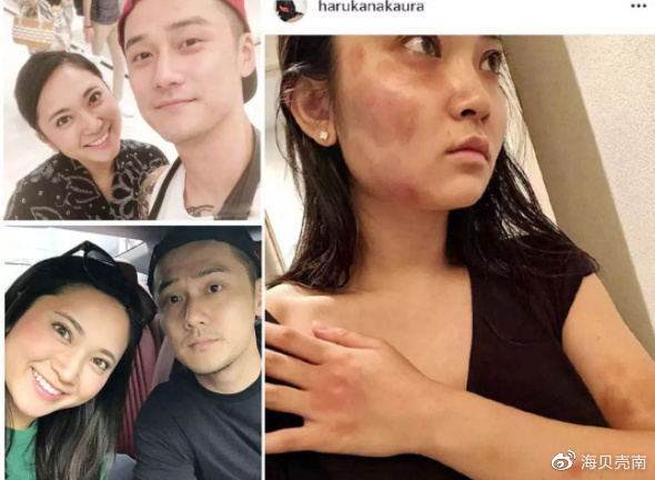 王东家暴连累同名主持人,妻子回复网友评论,又是受害者有罪论?休闲区蓝鸢梦想 - Www.slyday.coM 王东家暴连累同名主持人,妻子回复网友评论,又是受害者有罪论?休闲区蓝鸢梦想 - Www.slyday.coM