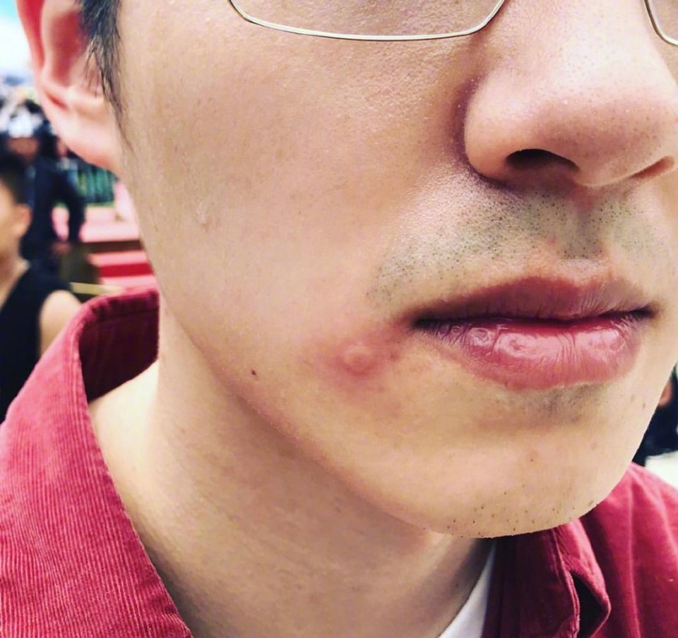 正在贵州拍摄 的 ,在社交平台晒出一张脸部特写