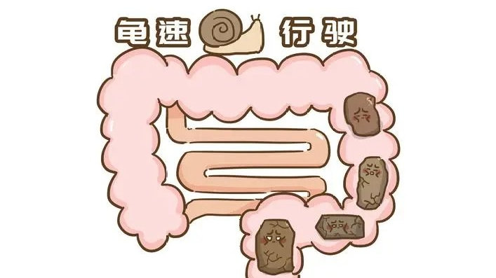 便秘代谢不好吗