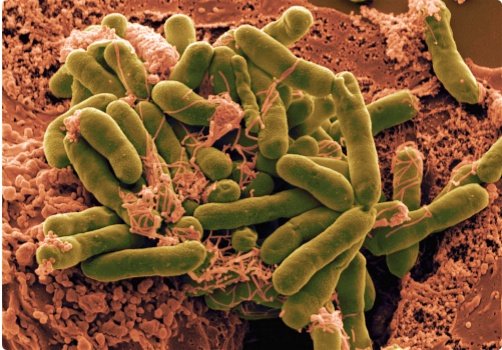 微生物学大肠杆菌是怎么传播的