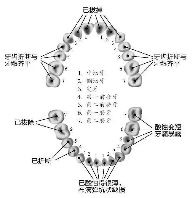 臼齿结构图片