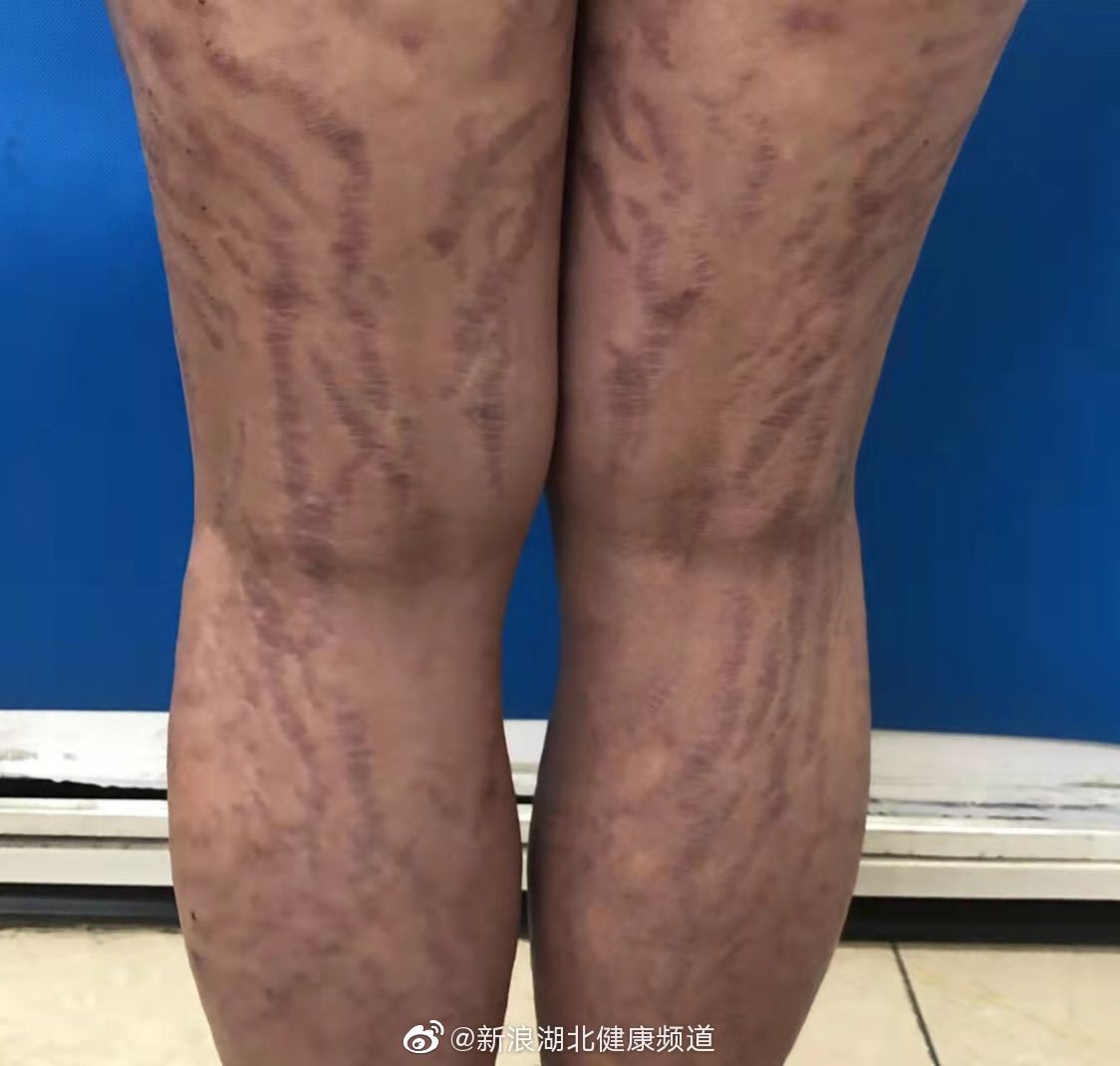 痛心穿短装将成为14岁女孩的奢侈