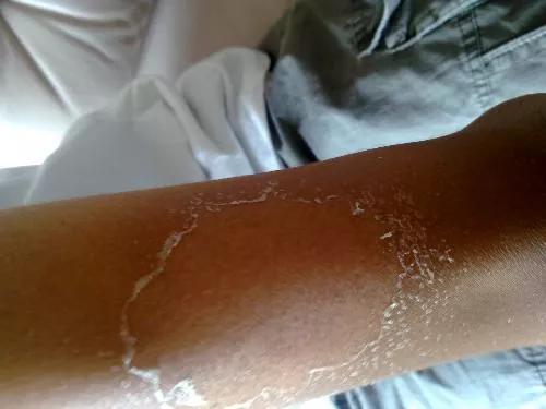 生怕有一点儿皮肤接触到太阳公公的照射,晒黑不说,还会伤到肌肤.