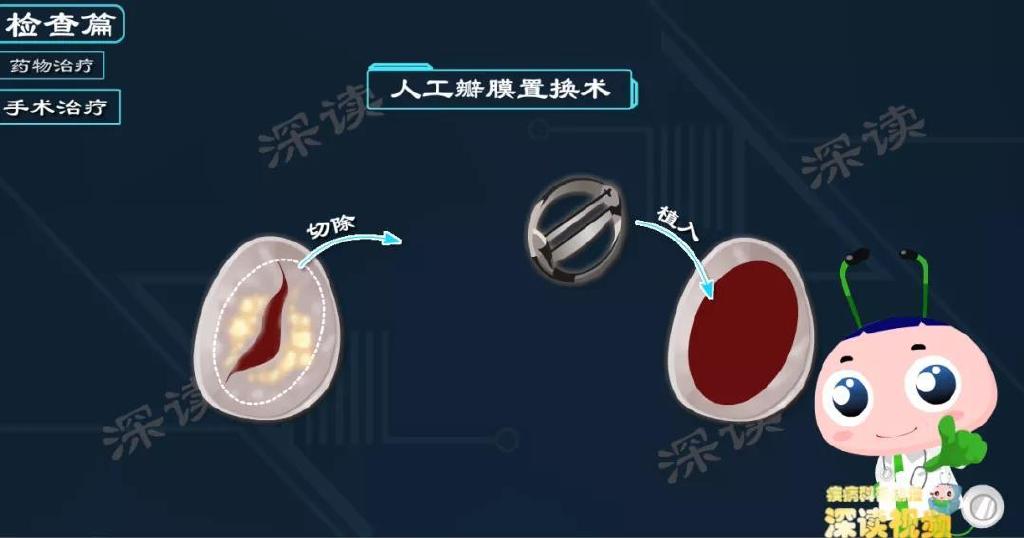 风心病控制不好要手术瓣膜修补置换该咋选治疗黑科技大盘点