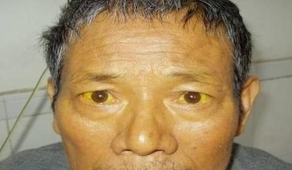 身体有恙,头部会发出"求救信号",早点抓住,不要掉以轻心