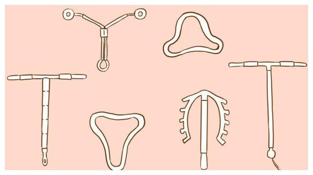 节育环的避孕原理是通过子宫腔内刺激以及化学物质的干扰,从而影响