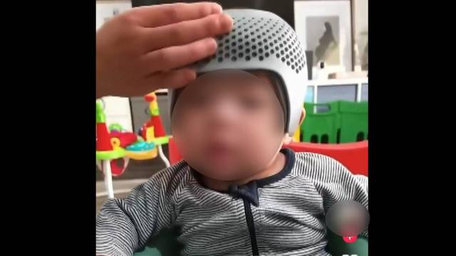 28万元矫正型头盔究竟是不是智商税家长们看过来