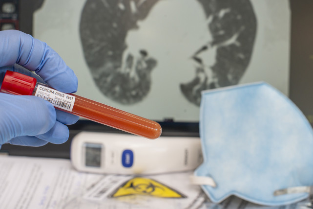 美重磅研究公布！新冠病毒可在感染数日内传至心脏和大脑，存活数月休闲区蓝鸢梦想 - Www.slyday.coM