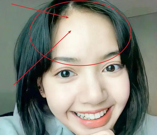 粉墨成员遭发际线危机lisa只能"铁刘海",珍妮"秃头"引热议