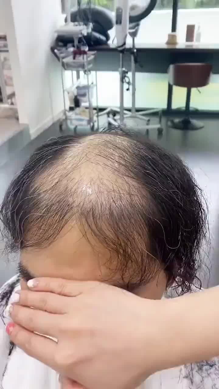 秃头哭着要的发型