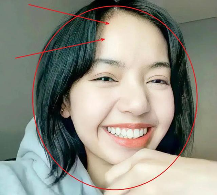 粉墨成员遭发际线危机lisa只能"铁刘海",珍妮"秃头"引热议