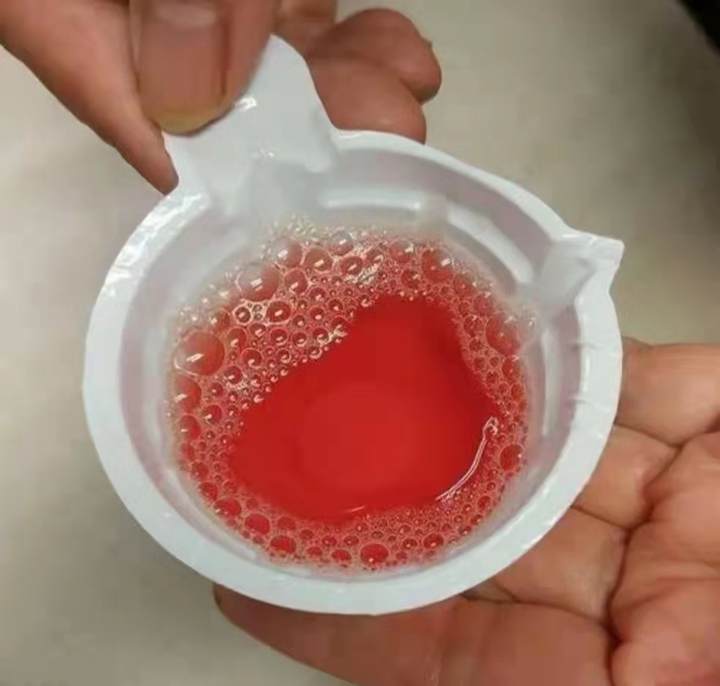 a1:每天早上观察自己排出的尿液是否出现尿色变化,如肉眼血尿,茶色尿