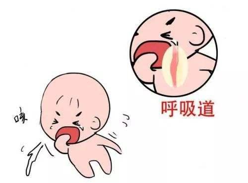 惊厥的时间较长,惊厥可反复发生,还伴有嗜睡烦躁等表现4呼吸急促呼吸