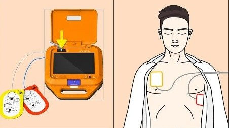 亚马逊运营listing优化A+页面 跨境电商产品排名提升方法