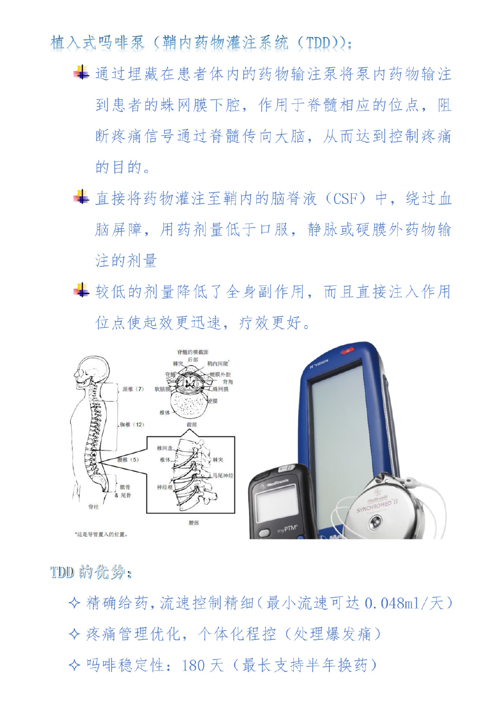 不到40岁吃遍止痛药仍难止痛小小一个泵解决疼痛难题