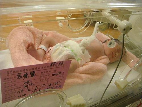 没想到出现大出血,34周就紧急剖腹产|二手烟|胎儿|剖腹产_新浪新闻