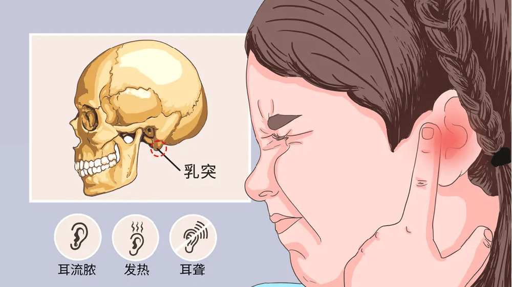 首大肖志:耳朵后面凸起的骨头叫什么|乳突炎|耳鼻喉科|乳突|颞骨|中耳炎_新浪新闻