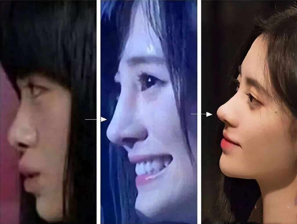 影视圈"假鼻子"大赏:谁堪称点睛之笔,谁"越整越残"?