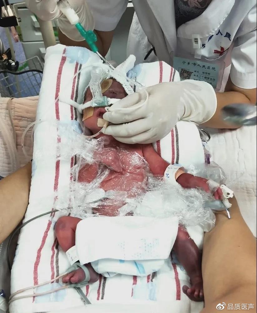 肺泡进行性萎陷,患儿于生后4～12小时内出现进行性呼吸困难,呻吟,发绀