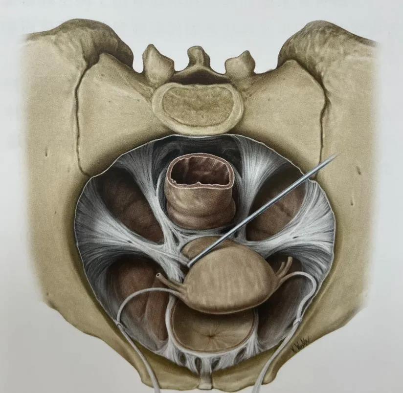 生完孩子骨盆疼痛怎么办