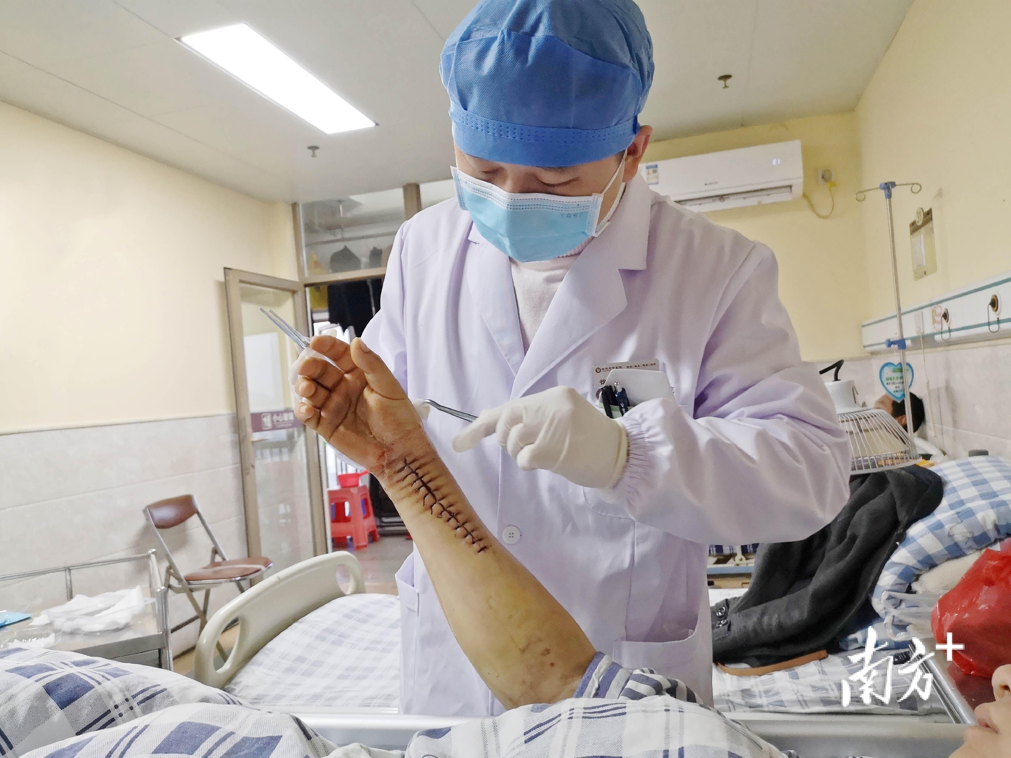 两边同时开刀英德市中医院成功开展多处多段骨折手术