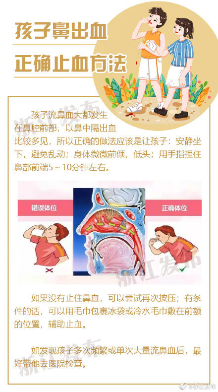 孩子鼻子出血,应该这样止血