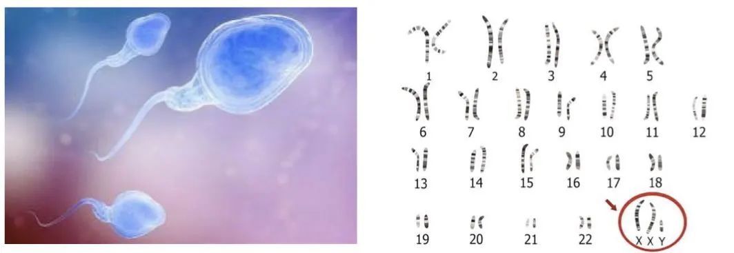 奇怪的糖尿病③丨欲"爸"不能的糖尿病|小张|克氏|染色体_新浪新闻