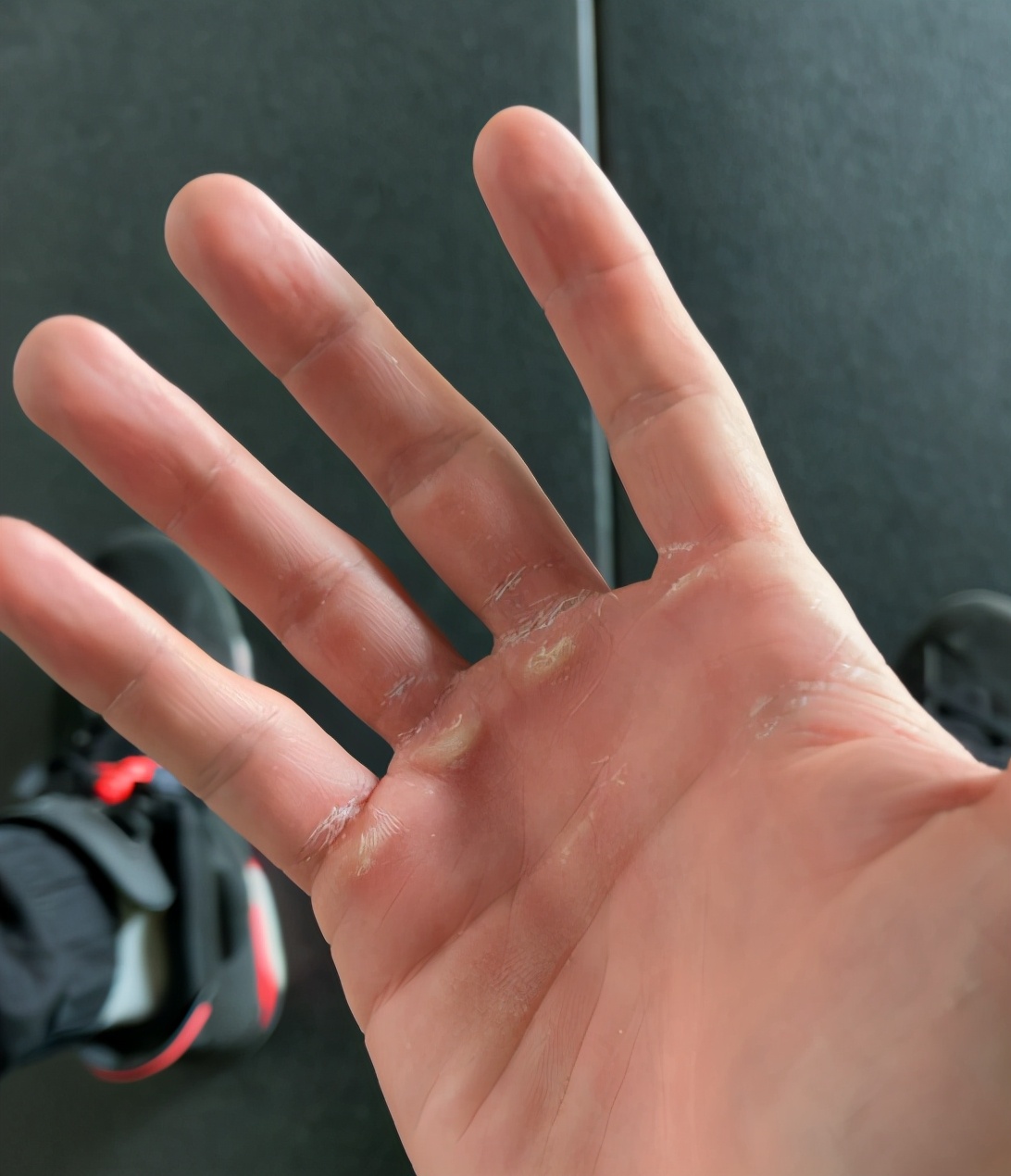 22岁阿尔法练出一身腱子肉!背部毛发旺盛,用力过猛手部磨脱皮