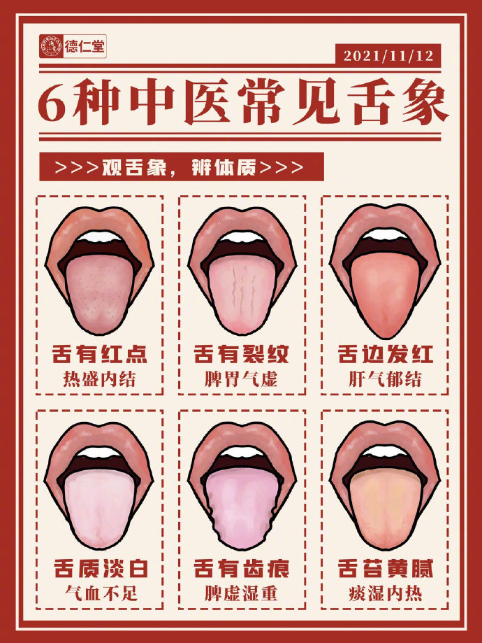 从舌苔看健康跟中医学舌诊这6种需要注意