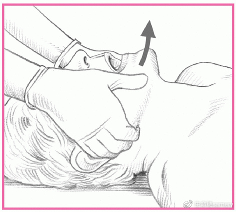 为创伤性心脏骤停的伤员施行复苏需作改动吗?