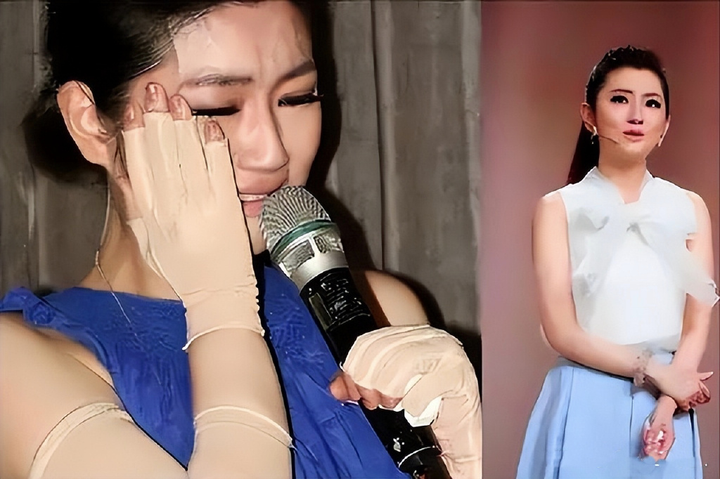 selina和男友出游,挺孕肚过母亲节,大方晒出双腿烧伤疤痕不自卑__财经