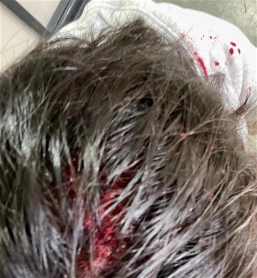 多名中国留学生在英国谢菲尔德遇袭，受害者多为女生，有人被敲破头休闲区蓝鸢梦想 - Www.slyday.coM