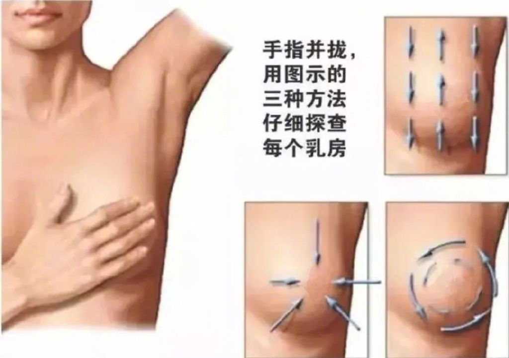 “乳房有结节,一碰就疼!”:这个女性疾病,10女9中招,会变乳腺癌休闲区蓝鸢梦想 - Www.slyday.coM “乳房有结节,一碰就疼!”:这个女性疾病,10女9中招,会变乳腺癌休闲区蓝鸢梦想 - Www.slyday.coM