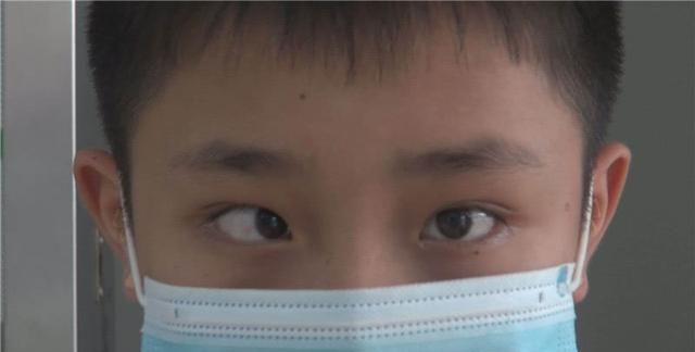 近视之后又现斗鸡眼已有多个孩子中招家长一定要注意