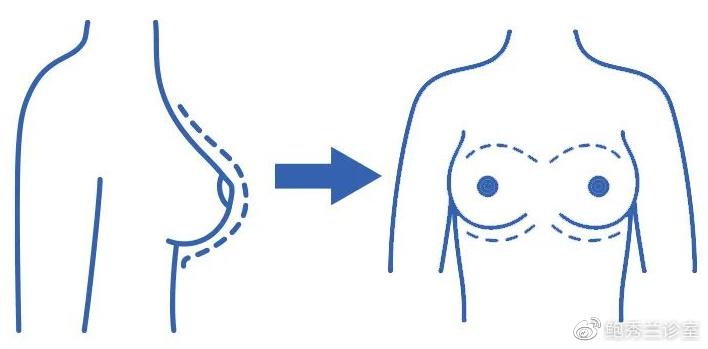 “乳房有结节,一碰就疼!”:这个女性疾病,10女9中招,会变乳腺癌休闲区蓝鸢梦想 - Www.slyday.coM “乳房有结节,一碰就疼!”:这个女性疾病,10女9中招,会变乳腺癌休闲区蓝鸢梦想 - Www.slyday.coM