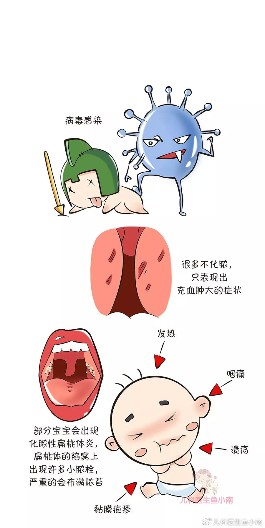 宝宝扁桃体老发炎,切还是不切?医生:看这5点|宝宝_新浪新闻