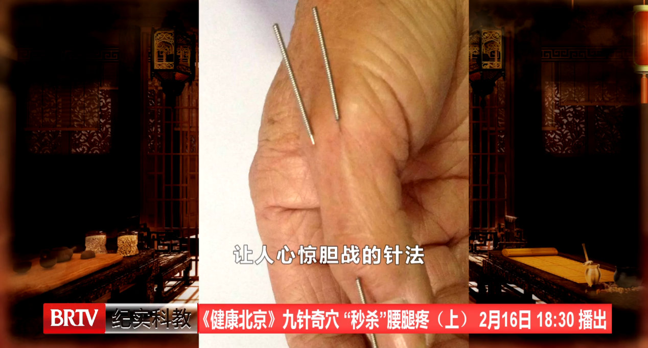 保守治疗加上微创治疗,也就是借助我们传统中医的针灸疗法和奇穴手法