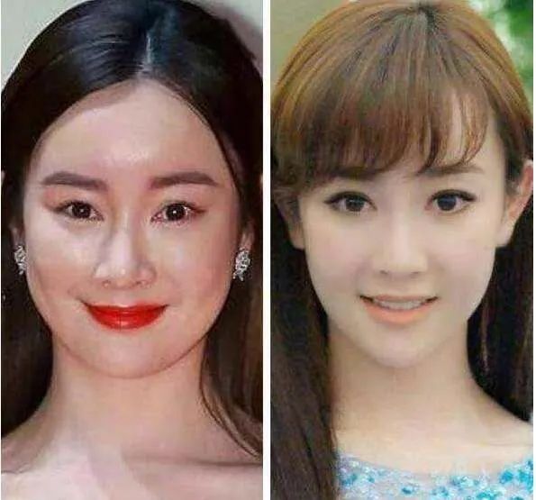 整容失败的艺人，有人成异形美羊羊，有人无戏可拍，有人直播带货|异形|整容|孙菲菲_新浪新闻