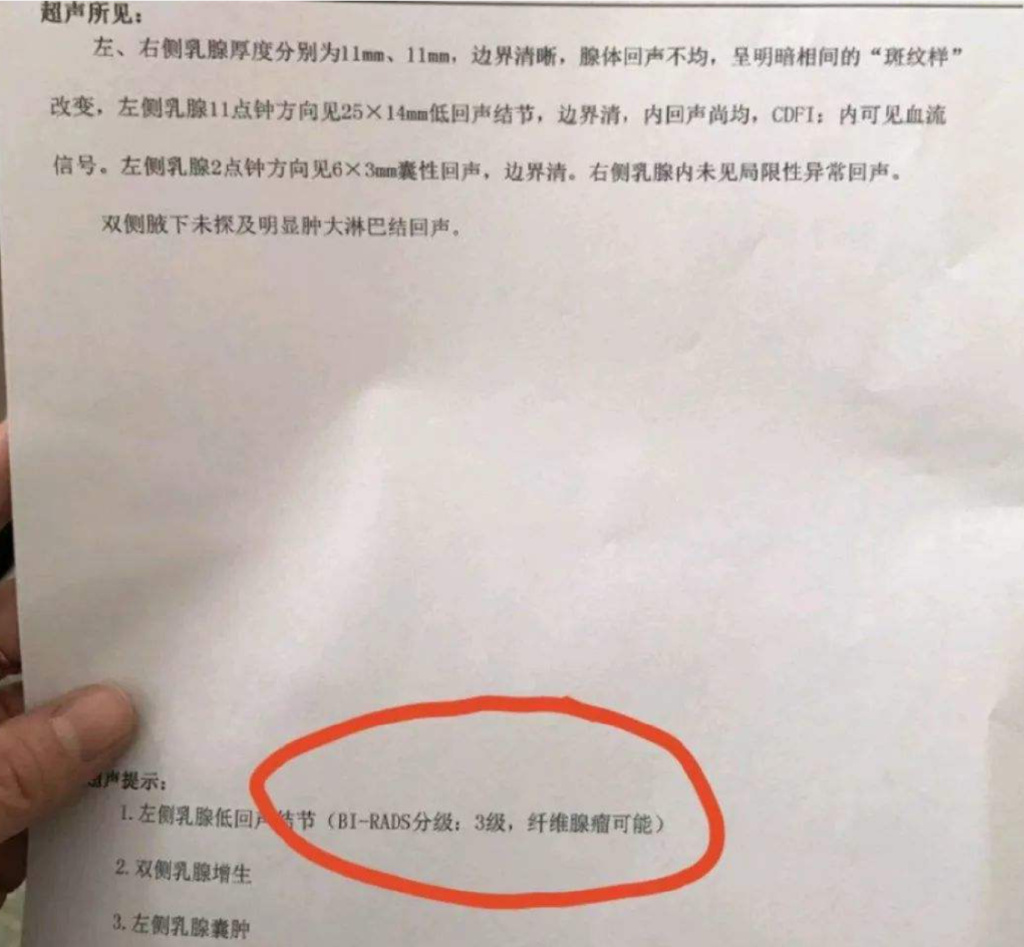 “乳房有结节,一碰就疼!”:这个女性疾病,10女9中招,会变乳腺癌休闲区蓝鸢梦想 - Www.slyday.coM “乳房有结节,一碰就疼!”:这个女性疾病,10女9中招,会变乳腺癌休闲区蓝鸢梦想 - Www.slyday.coM