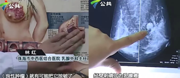 “乳房有结节,一碰就疼!”:这个女性疾病,10女9中招,会变乳腺癌休闲区蓝鸢梦想 - Www.slyday.coM “乳房有结节,一碰就疼!”:这个女性疾病,10女9中招,会变乳腺癌休闲区蓝鸢梦想 - Www.slyday.coM