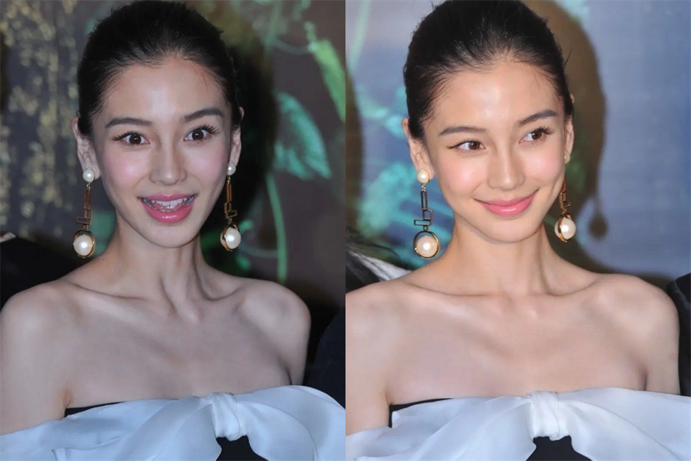 baby早期参加活动照高清生图下露真颜发际线被质疑太靠后